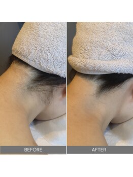 ハウオリ スパ(Hau’Oli Spa)/【ブライダルエステ】