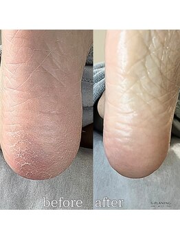 フットミー(foot mii)/