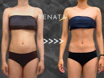 レナータ 大宮店(RENATA)の写真
