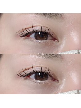 リム(rm.)/エクステ140本