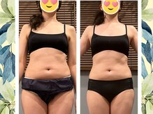 ヨサパーク ハーブ ラキ 鳴海店(YOSA PARK herb *Laki)/ルルオン11回変化【緑区/痩身】