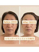 ナユラスパ(Nayula Spa)/脂肪分解レモンボトル