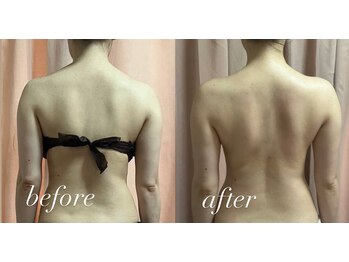 リシェカ(Richeka)/カチカチの肩甲骨の1回の変化