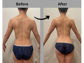 テン エイト(10 8)/上半身撃退