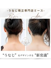 ミース 長野店/うなじ矯正◆ビフォーアフター