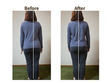 フェルナ(FERNA)/