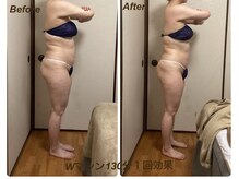 ミュー 新小岩店(Mieux)/Wマシン130分1回効果