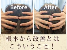スウ(suu.)/Before-After【30代】1回
