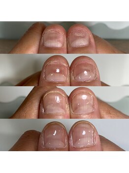 フェミニンネイル(Feminine Nail)/