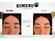 キメル(KIMERU)の写真