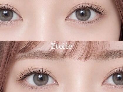 エトワール(Etoile)の写真