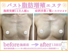 サラエクセレント 新宿(SARA EXCELLENT)の雰囲気（カウンセリングからバストアップニストにお任せ♪元祖脂肪増殖店）