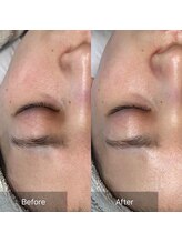 ホワイトアクア 京都店(WHITE AQUA)/ララピール/京都