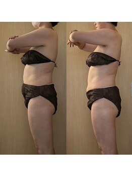 ココア(CoCoa)/セルクラ