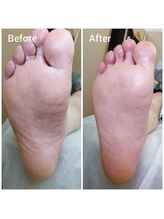 リゼラアンドコー 矢板店/