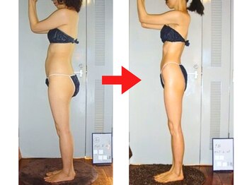 痩身 セル脂肪専門 スタイルデザイン/モデルの様な長く細い脚ですね♪