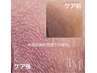 ルメラ《外陰部ホワイトケア》 今ならアフタークリーム1本プレゼント♪