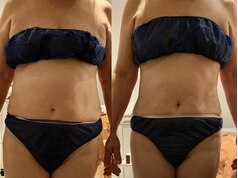 【30～50代女性/結果重視】お腹・背中・脚まで全身痩身　￥12.000