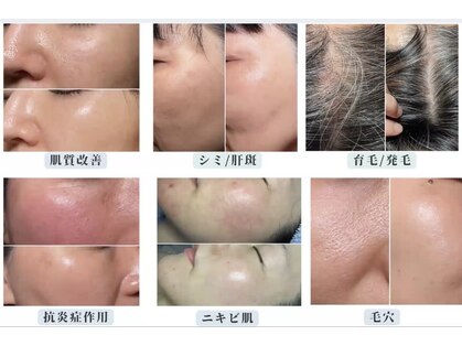 リュミエール デスポワール(Lumiere d'espoir)の写真