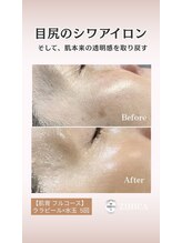 ジヒカ(ZIHICA)/【肌育フルコース】