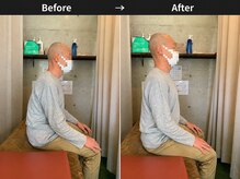 リセット整骨院しぎの院/BeforeAfter