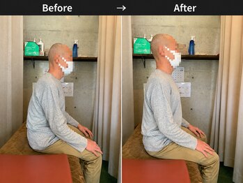 リセット整骨院しぎの院/BeforeAfter