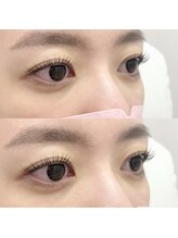 コンジュ ファースト 土橋店(CONJU 1st)/アッパーリフトカールカール