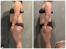 ツーアップ(2up)/お腹太ももの厚み