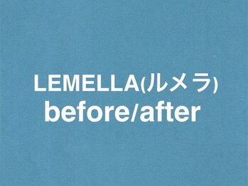 エムフロート(M FLOAT)/lemella/ルメラ/メラニンケア