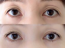 シャール(shall)/まつ毛パーマ/まつげ/マツパ