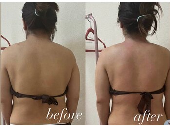 リシェカ(Richeka)/産後太り解消