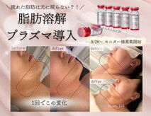 アンフィア(Anfia)