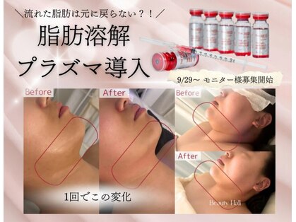 アンフィア(Anfia)の写真