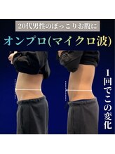 ラフィール/マイクロ派 (20分)かけ放題