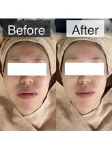 ベルフィーヌ 恵比寿店(BELFINE)/面長さんもお任せください！