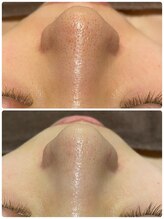 アネル 浦添店(anel)/