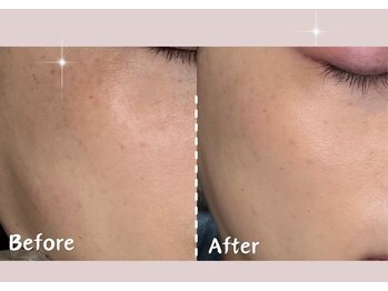 シー センター北(sii)/フォト美顔