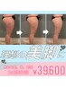 ボコボコのセル脂肪解消★1ヶ月集中ケア4回　　48400円→39600円