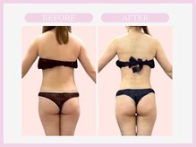 スリムライン 盛岡店(The Slim Line)/before→after