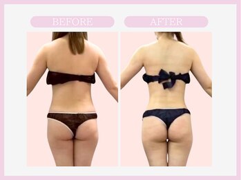 スリムライン 盛岡店(The Slim Line)/before→after