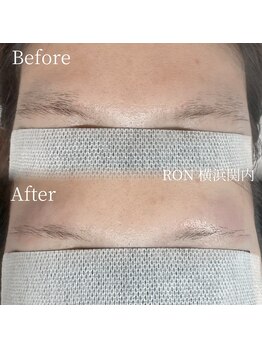 サロンロン 横浜関内(SALON RON)/眉毛/美容電気脱毛