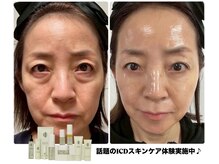 超話題！韓国肌管理スキンケアICDのお取り扱い始まりました