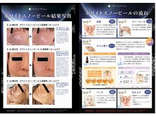 エバタエステティック 西葛西店(ebata ESTHETIQUE)/春の紫外線対策＆美白ケア
