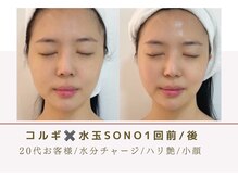 ルナビューティー 赤坂(LUNA beauty)/韓国定番肌管理水玉SONOケア