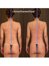 エミナル(EMINALu)/結果☆CHINOTHEMETHOD　Luxury