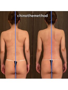 エミナル(EMINALu)/結果☆CHINOTHEMETHOD　Luxury