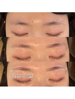 顔肌革命 ビューティアンドヘルス バイ メール(beauty&health by mer)/眉毛ワックス脱毛×おでこ