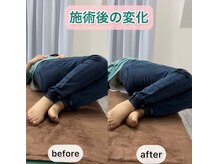 シオ 横浜関内(sio)/施術後の変化BeforeAfter