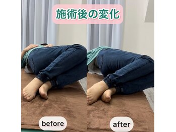 シオ 横浜関内(sio)/施術後の変化BeforeAfter