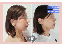 サロン アンドケー(Salon&K)の雰囲気（中四国初！小顔調整×骨格調整）